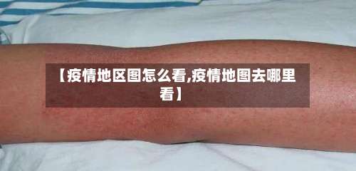 【疫情地区图怎么看,疫情地图去哪里看】-第1张图片